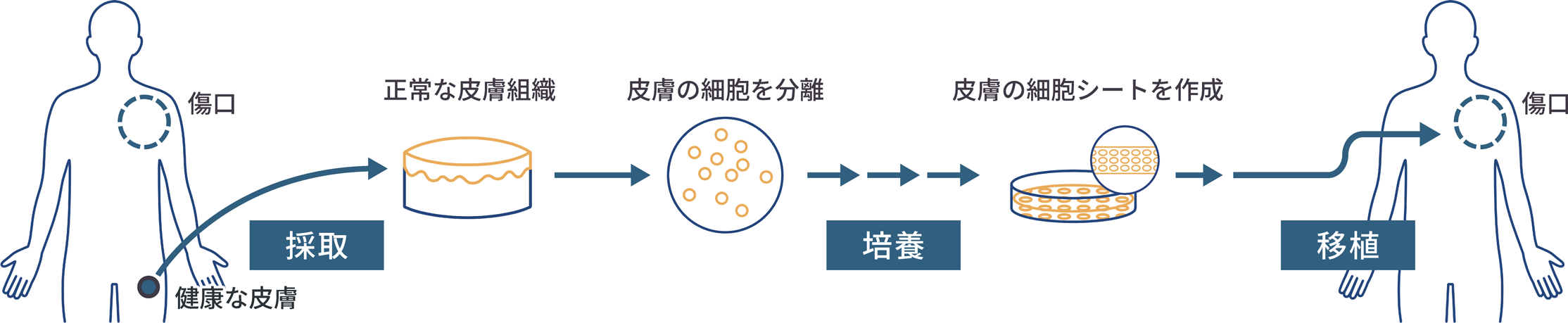 ヒト細胞加工製品のフロー
