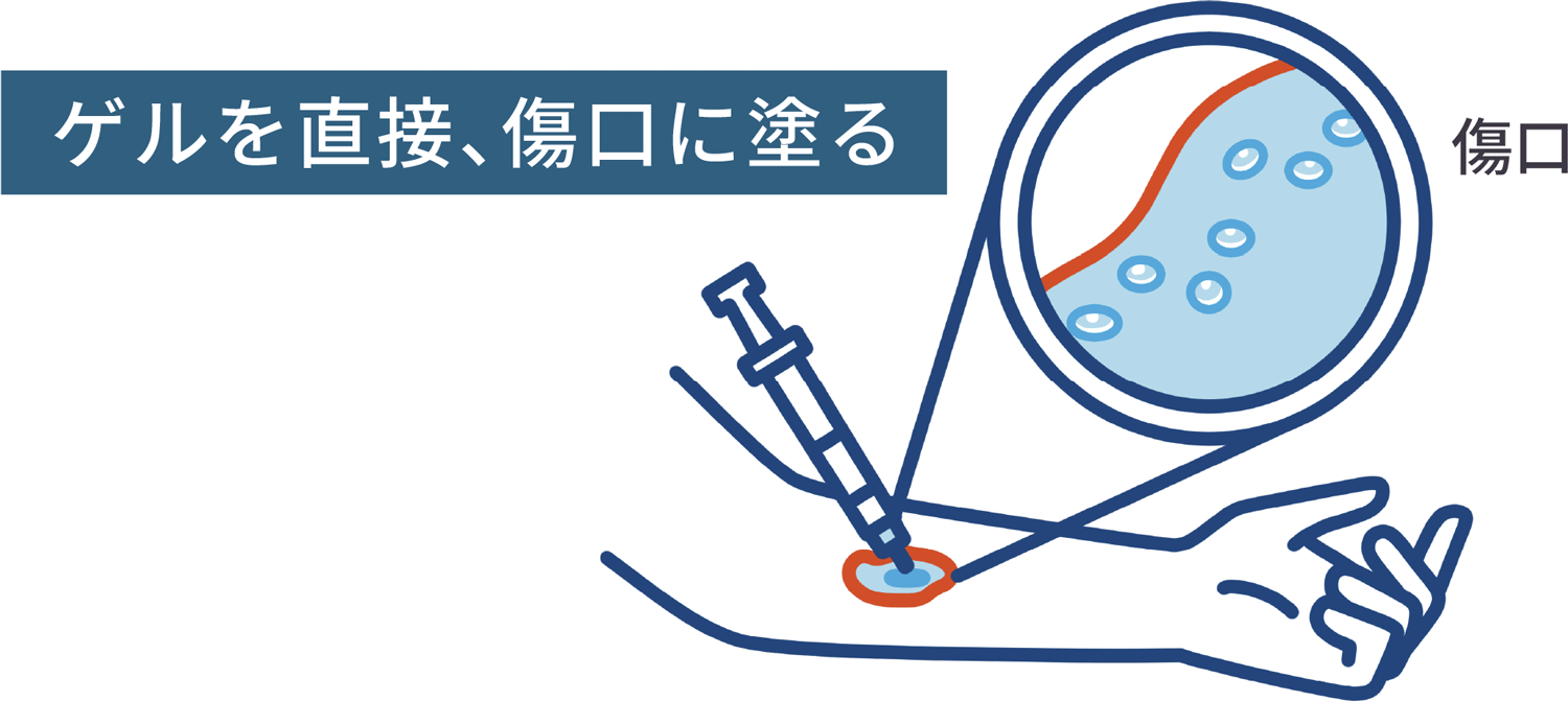 遺伝子治療用製品の図解